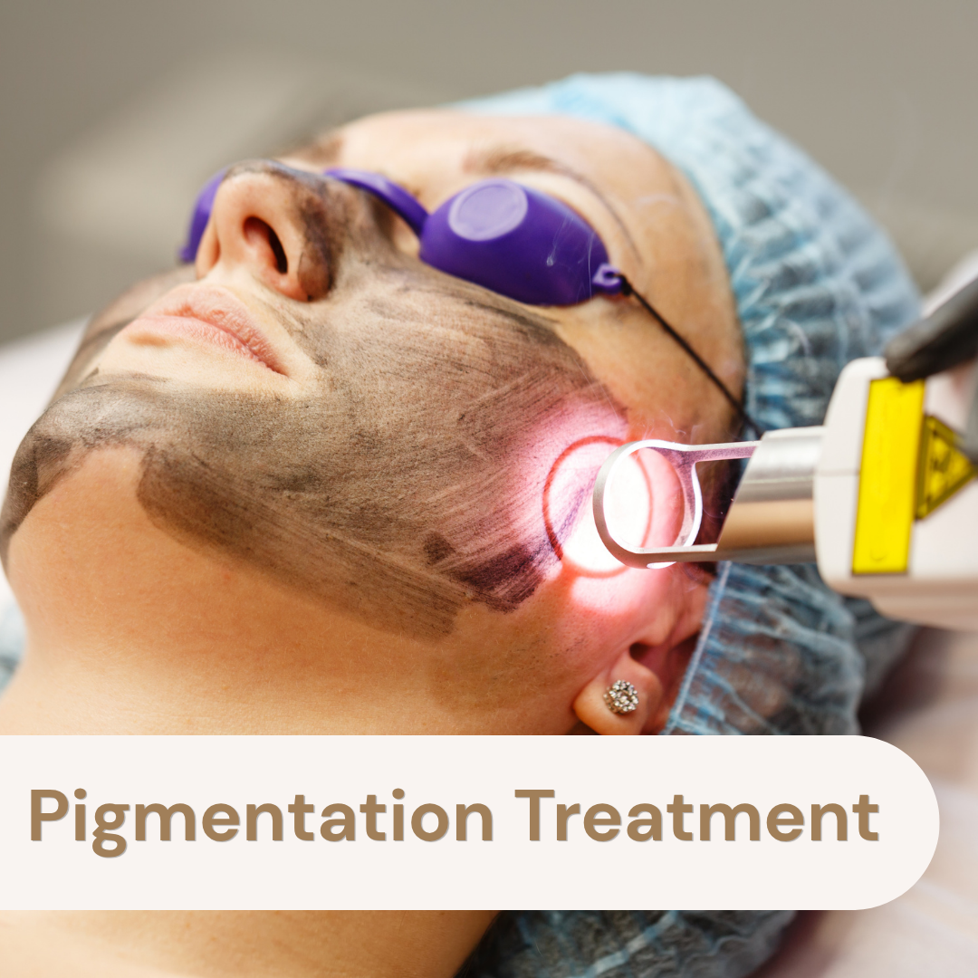 Pigmentation Treatment